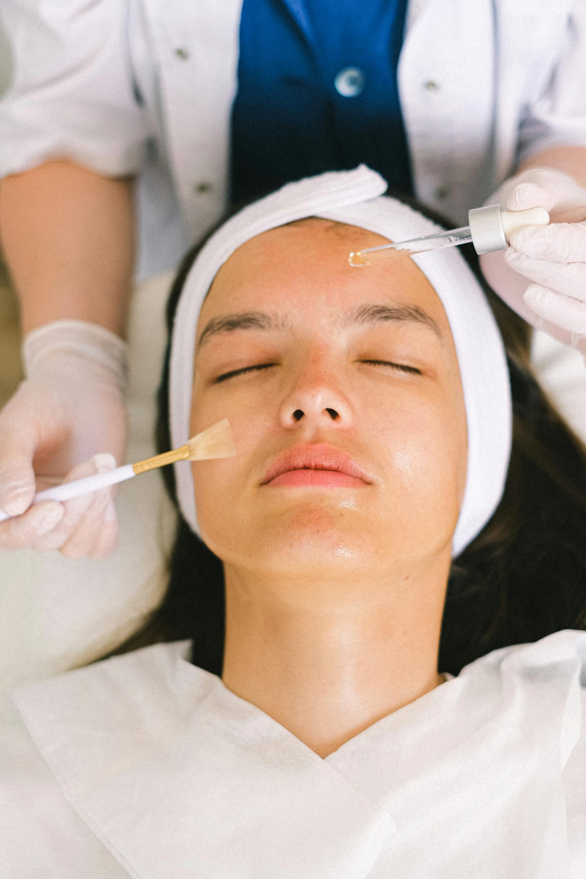 Chemical Peels
